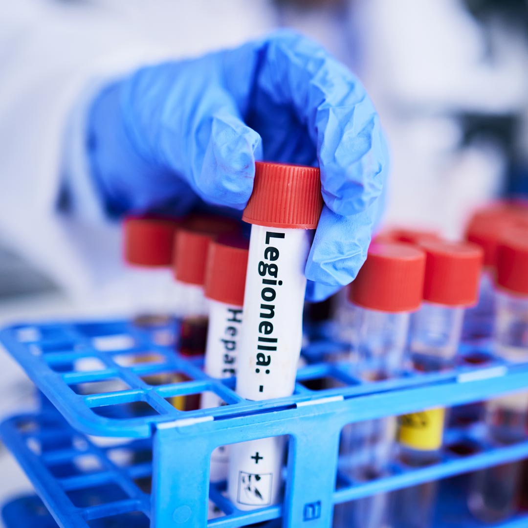 Scientist, hand and bacteria sample in test tube, person in lab with medical research